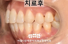 수술후