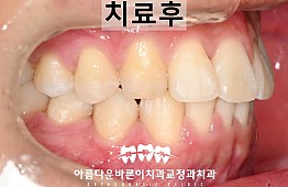 수술후
