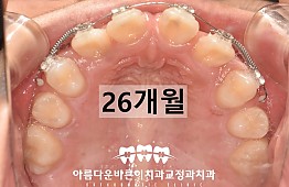 수술후