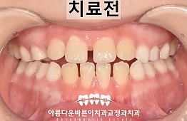 수술전