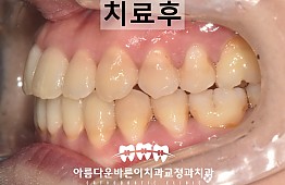 수술후