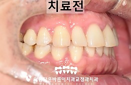 수술전