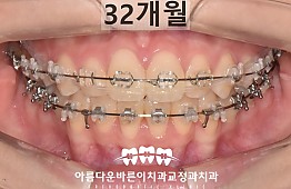 수술후