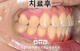 수술후