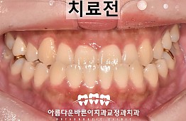 수술전