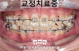 수술후