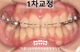 수술후