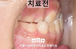 수술전