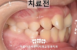 수술전