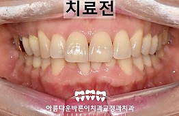 수술전