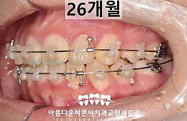 수술후