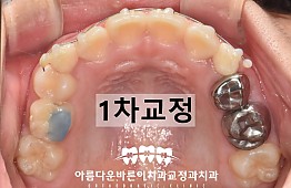 수술후