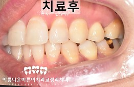 수술후