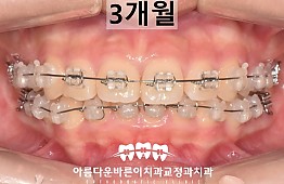 수술후