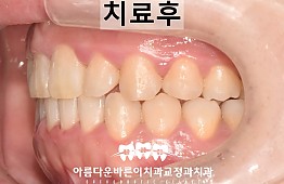 수술후