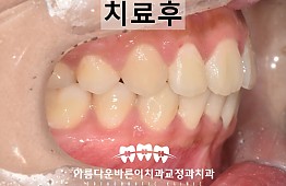 수술후