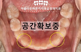 수술후