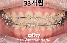 수술후