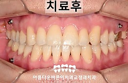수술후