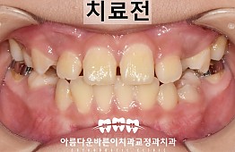 수술전