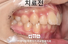 수술전