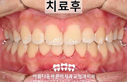 수술후