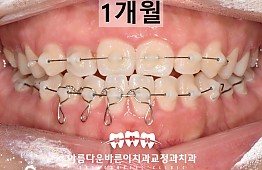 수술후