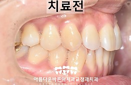 수술전