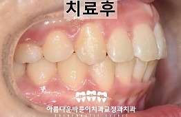 수술후