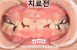 수술전