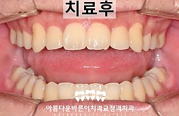 수술후