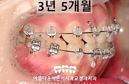 수술후