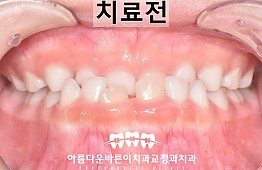 수술전