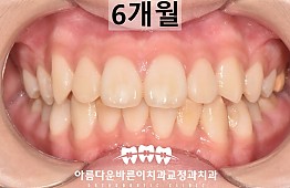 수술후