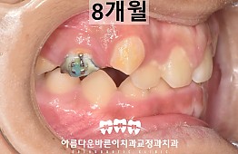 수술후