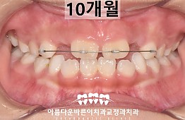 수술후