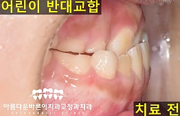 수술전