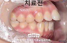 수술전