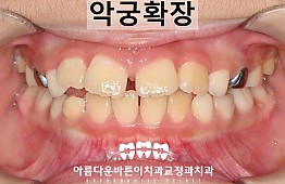 수술후