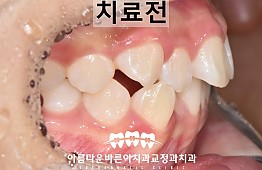 수술전