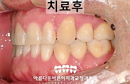 수술후