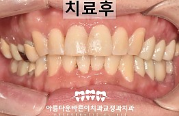 수술후