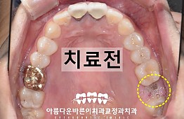 수술전