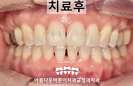 수술후