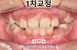 수술후