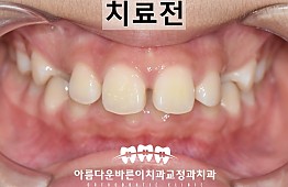 수술전