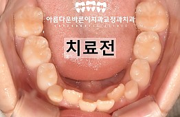 수술전