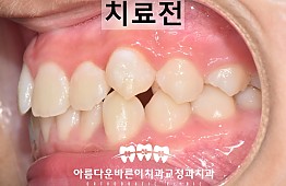 수술전