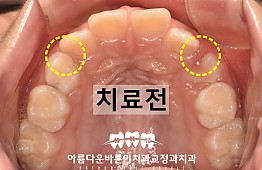 수술전