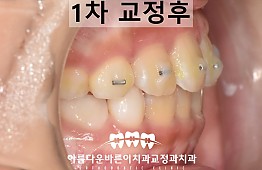 수술후